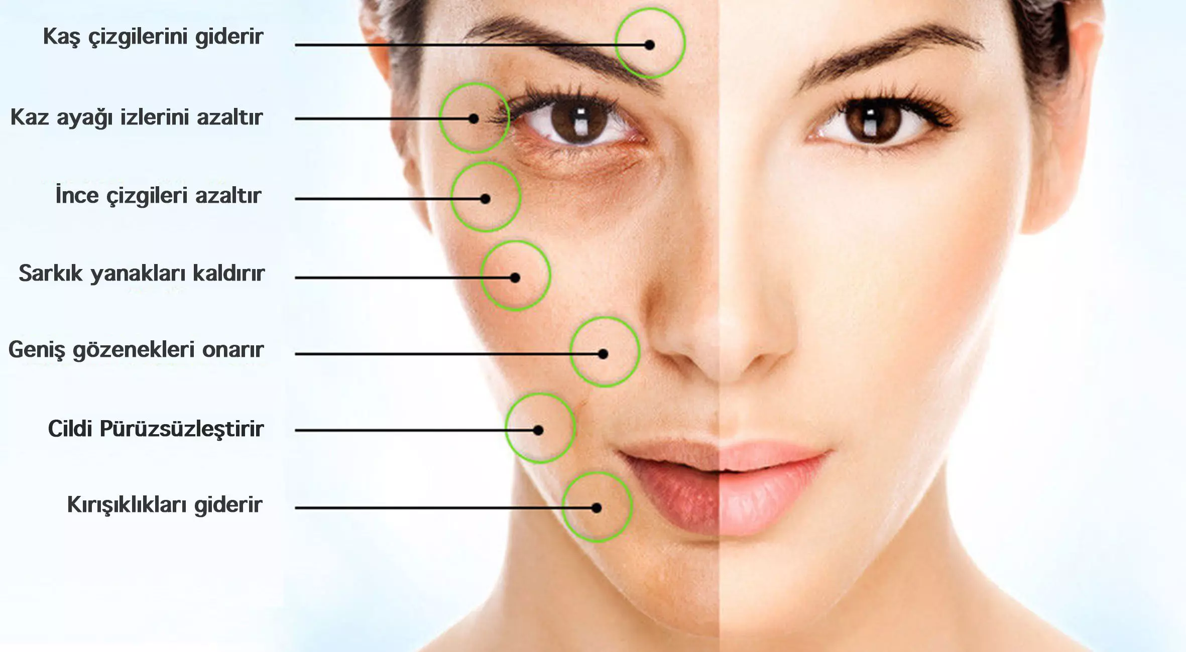 yuz-mezoterapisi